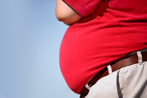 چاقی در میانسالی با احتمال بیشتر ابتلا به زوال عقل مرتبط است